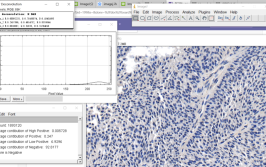 免疫分析图片FIJIImageJ(免疫分析图片密度创作者)