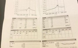 基因组耳鸣噪声听力下降(基因噪声基因组听力阶段)「基因问题导致听力差,怎么办」