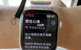 心电图细节功能AppleWatch(心电图房颤功能心率心律)