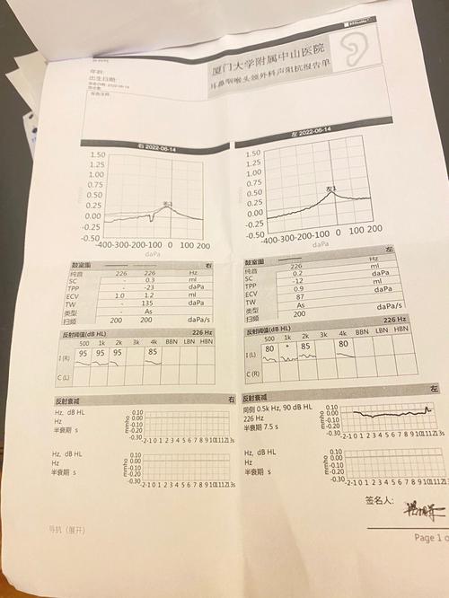 基因组耳鸣噪声听力下降(基因噪声基因组听力阶段)